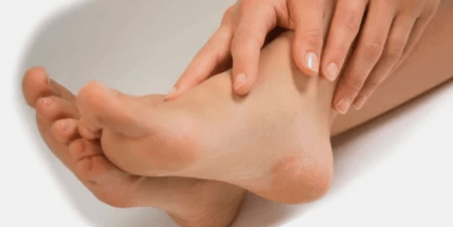 Tratamento do fungo das uñas