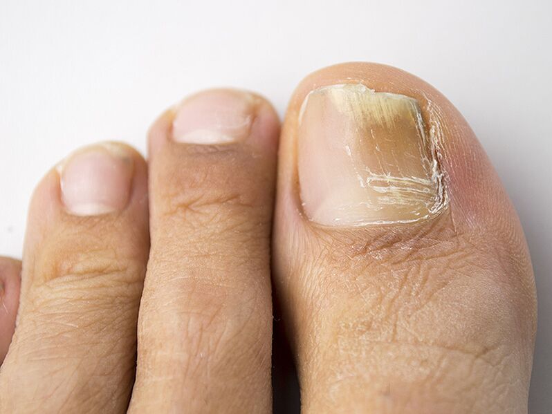 A fase inicial do cogomelo